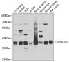 Western blot analysis of extracts of various cell lines, using DYNC2LI1 antibody (19-460) at 1:1000 dilution.<br/>Secondary antibody: HRP Goat Anti-Rabbit IgG (H+L) at 1:10000 dilution.<br/>Lysates/proteins: 25ug per lane.<br/>Blocking buffer: 3% nonfat dry milk in TBST.<br/>Detection: ECL Basic Kit.<br/>Exposure time: 5s.