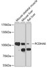 Western blot analysis of extracts of various cell lines, using PCDHA6 antibody (19-489) at 1:1000 dilution.<br/>Secondary antibody: HRP Goat Anti-Rabbit IgG (H+L) at 1:10000 dilution.<br/>Lysates/proteins: 25ug per lane.<br/>Blocking buffer: 3% nonfat dry milk in TBST.<br/>Detection: ECL Basic Kit.<br/>Exposure time: 30s.