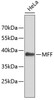 Western blot analysis of extracts of HeLa cells, using MFF antibody (19-490) .<br/>Secondary antibody: HRP Goat Anti-Rabbit IgG (H+L) at 1:10000 dilution.<br/>Lysates/proteins: 25ug per lane.<br/>Blocking buffer: 3% nonfat dry milk in TBST.