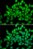 Immunofluorescence analysis of A549 cells using ALS2 antibody (19-493) . Blue: DAPI for nuclear staining.