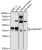 Western blot analysis of extracts of various cell lines, using AASDHPPT antibody (19-496) at 1:3000 dilution.<br/>Secondary antibody: HRP Goat Anti-Rabbit IgG (H+L) at 1:10000 dilution.<br/>Lysates/proteins: 25ug per lane.<br/>Blocking buffer: 3% nonfat dry milk in TBST.<br/>Detection: ECL Basic Kit.<br/>Exposure time: 30s.