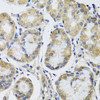 Immunohistochemistry of paraffin-embedded human stomach using MRPL1 antibody (19-505) at dilution of 1:100 (40x lens) .