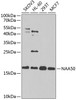 Western blot analysis of extracts of various cell lines, using NAA50 antibody (19-519) at 1:1000 dilution.<br/>Secondary antibody: HRP Goat Anti-Rabbit IgG (H+L) at 1:10000 dilution.<br/>Lysates/proteins: 25ug per lane.<br/>Blocking buffer: 3% nonfat dry milk in TBST.<br/>Detection: ECL Enhanced Kit.<br/>Exposure time: 90s.