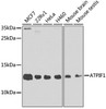 Western blot analysis of extracts of various cell lines, using ATPIF1 antibody (19-532) at 1:1000 dilution.<br/>Secondary antibody: HRP Goat Anti-Rabbit IgG (H+L) at 1:10000 dilution.<br/>Lysates/proteins: 25ug per lane.<br/>Blocking buffer: 3% nonfat dry milk in TBST.<br/>Detection: ECL Basic Kit.<br/>Exposure time: 90s.