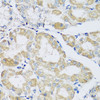 Immunohistochemistry of paraffin-embedded human stomach using ATPIF1 antibody (19-532) at dilution of 1:100 (40x lens) .