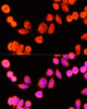 Immunofluorescence analysis of Hela cells using GSTK1 antibody (19-545) at dilution of 1:100 (40x lens) . Blue: DAPI for nuclear staining.