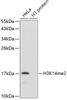 Western blot analysis of extracts of various cell lines, using DiMethyl-Histone H3-K14 antibody (19-559) .<br/>Secondary antibody: HRP Goat Anti-Rabbit IgG (H+L) at 1:10000 dilution.<br/>Lysates/proteins: 25ug per lane.<br/>Blocking buffer: 3% nonfat dry milk in TBST.