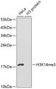 Western blot analysis of extracts of various cell lines, using TriMethyl-Histone H3-K14 antibody (19-560) .<br/>Secondary antibody: HRP Goat Anti-Rabbit IgG (H+L) at 1:10000 dilution.<br/>Lysates/proteins: 25ug per lane.<br/>Blocking buffer: 3% nonfat dry milk in TBST.