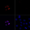 Immunofluorescence analysis of C6 cells treated by TSA (upper left) and untreated C6 cells (upper right) using Acetyl-Histone H4-K16 Rabbit pAb (red, 19-561) at dilution of 1:100. Blue: DAPI for nuclear staining.