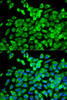 Immunofluorescence analysis of MCF-7 cells using EIF4A1 antibody (19-567) . Blue: DAPI for nuclear staining.