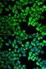 Immunofluorescence analysis of A549 cells using C10orf2 antibody (19-572) . Blue: DAPI for nuclear staining.