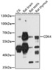Western blot analysis of extracts of various cell lines, using CAMK4 antibody (19-573) at 1:1000 dilution.<br/>Secondary antibody: HRP Goat Anti-Rabbit IgG (H+L) at 1:10000 dilution.<br/>Lysates/proteins: 25ug per lane.<br/>Blocking buffer: 3% nonfat dry milk in TBST.<br/>Detection: ECL Basic Kit.<br/>Exposure time: 90s.