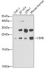 Western blot analysis of extracts of various cell lines, using CBFB antibody (19-574) at 1:1000 dilution._Secondary antibody: HRP Goat Anti-Rabbit IgG (H+L) at 1:10000 dilution._Lysates/proteins: 25ug per lane._Blocking buffer: 3% nonfat dry milk in TBST._Detection: ECL Enhanced Kit._Exposure time: 90s.