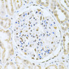 Immunohistochemistry of paraffin-embedded human kidney cancer using CBFB Antibody (19-574) at dilution of 1:200 (40x lens) .