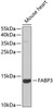 Western blot analysis of extracts of mouse heart, using FABP3 antibody (19-580) at 1:1000 dilution.<br/>Secondary antibody: HRP Goat Anti-Rabbit IgG (H+L) at 1:10000 dilution.<br/>Lysates/proteins: 25ug per lane.<br/>Blocking buffer: 3% nonfat dry milk in TBST.<br/>Detection: ECL Basic Kit.<br/>Exposure time: 90s.