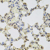 Immunohistochemistry of paraffin-embedded rat lung using GTF2H2 antibody (19-583) at dilution of 1:100 (40x lens) .