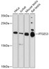 Western blot analysis of extracts of various cell lines, using PTGES3 antibody (19-589) at 1:1000 dilution.<br/>Secondary antibody: HRP Goat Anti-Rabbit IgG (H+L) at 1:10000 dilution.<br/>Lysates/proteins: 25ug per lane.<br/>Blocking buffer: 3% nonfat dry milk in TBST.<br/>Detection: ECL Enhanced Kit.<br/>Exposure time: 90s.
