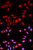 Immunofluorescence analysis of U2OS cells using RCAN1 antibody (19-590) . Blue: DAPI for nuclear staining.