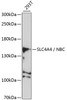 Western blot analysis of extracts of 293T cells, using SLC4A4 / NBC antibody (19-594) at 1:1000 dilution.<br/>Secondary antibody: HRP Goat Anti-Rabbit IgG (H+L) at 1:10000 dilution.<br/>Lysates/proteins: 25ug per lane.<br/>Blocking buffer: 3% nonfat dry milk in TBST.<br/>Detection: ECL Basic Kit.<br/>Exposure time: 30s.