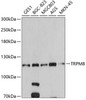 Western blot analysis of extracts of various cell lines, using TRPM8 antibody (19-595) at 1:500 dilution.<br/>Secondary antibody: HRP Goat Anti-Rabbit IgG (H+L) at 1:10000 dilution.<br/>Lysates/proteins: 25ug per lane.<br/>Blocking buffer: 3% nonfat dry milk in TBST.<br/>Detection: ECL Basic Kit.<br/>Exposure time: 60s.