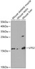 Western blot analysis of extracts of various cell lines, using UTS2 antibody (19-596) at 1:1000 dilution.<br/>Secondary antibody: HRP Goat Anti-Rabbit IgG (H+L) at 1:10000 dilution.<br/>Lysates/proteins: 25ug per lane.<br/>Blocking buffer: 3% nonfat dry milk in TBST.<br/>Detection: ECL Basic Kit.<br/>Exposure time: 90s.