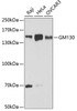 Western blot analysis of extracts of various cell lines, using GM130 antibody (19-604) at 1:1000 dilution.<br/>Secondary antibody: HRP Goat Anti-Rabbit IgG (H+L) at 1:10000 dilution.<br/>Lysates/proteins: 25ug per lane.<br/>Blocking buffer: 3% nonfat dry milk in TBST.<br/>Detection: ECL Basic Kit.<br/>Exposure time: 60s.