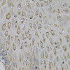 Immunohistochemistry of paraffin-embedded human esophagus using NEK2 Antibody (19-609) at dilution of 1:100 (40x lens) .