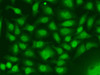 Immunofluorescence analysis of A549 cells using RAD17 antibody (19-613) .