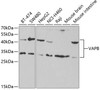 Western blot analysis of extracts of various cell lines, using VAPB antibody (19-617) at 1:1000 dilution.<br/>Secondary antibody: HRP Goat Anti-Rabbit IgG (H+L) at 1:10000 dilution.<br/>Lysates/proteins: 25ug per lane.<br/>Blocking buffer: 3% nonfat dry milk in TBST.