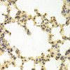 Immunohistochemistry of paraffin-embedded mouse lung using RANGAP1 antibody (19-628) at dilution of 1:100 (40x lens) .