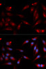 Immunofluorescence analysis of U2OS cells using ADAM9 antibody (19-633) . Blue: DAPI for nuclear staining.