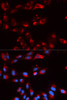 Immunofluorescence analysis of U2OS cells using CFP antibody (19-638) . Blue: DAPI for nuclear staining.