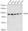 Western blot analysis of extracts of various cell lines, using EIF4B antibody (19-645) at 1:1000 dilution.<br/>Secondary antibody: HRP Goat Anti-Rabbit IgG (H+L) at 1:10000 dilution.<br/>Lysates/proteins: 25ug per lane.<br/>Blocking buffer: 3% nonfat dry milk in TBST.<br/>Detection: ECL Basic Kit.<br/>Exposure time: 1s.