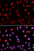 Immunofluorescence analysis of U2OS cells using HUS1 antibody (19-646) . Blue: DAPI for nuclear staining.