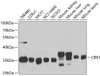 Western blot analysis of extracts of various cell lines, using CBR1 antibody (19-667) at 1:1000 dilution.<br/>Secondary antibody: HRP Goat Anti-Rabbit IgG (H+L) at 1:10000 dilution.<br/>Lysates/proteins: 25ug per lane.<br/>Blocking buffer: 3% nonfat dry milk in TBST.<br/>Detection: ECL Basic Kit.<br/>Exposure time: 5s.