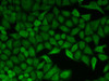 Immunofluorescence analysis of HeLa cells using CDC34 antibody (19-676) .