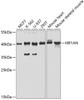 Western blot analysis of extracts of various cell lines, using HIF1AN antibody (19-681) at 1:1000 dilution.<br/>Secondary antibody: HRP Goat Anti-Rabbit IgG (H+L) at 1:10000 dilution.<br/>Lysates/proteins: 25ug per lane.<br/>Blocking buffer: 3% nonfat dry milk in TBST.<br/>Detection: ECL Basic Kit.<br/>Exposure time: 30s.