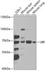 Western blot analysis of extracts of various cell lines, using LBR antibody (19-682) at 1:1000 dilution._Secondary antibody: HRP Goat Anti-Rabbit IgG (H+L) at 1:10000 dilution._Lysates/proteins: 25ug per lane._Blocking buffer: 3% nonfat dry milk in TBST._Detection: ECL Enhanced Kit._Exposure time: 90s.