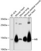 Western blot analysis of extracts of various cell lines, using MB antibody (19-685) at 1:1000 dilution.<br/>Secondary antibody: HRP Goat Anti-Rabbit IgG (H+L) at 1:10000 dilution.<br/>Lysates/proteins: 25ug per lane.<br/>Blocking buffer: 3% nonfat dry milk in TBST.<br/>Detection: ECL Basic Kit.<br/>Exposure time: 5s.