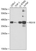 Western blot analysis of extracts of various cell lines, using PEX19 antibody (19-687) at 1:1000 dilution.<br/>Secondary antibody: HRP Goat Anti-Rabbit IgG (H+L) at 1:10000 dilution.<br/>Lysates/proteins: 25ug per lane.<br/>Blocking buffer: 3% nonfat dry milk in TBST.<br/>Detection: ECL Basic Kit.<br/>Exposure time: 90s.