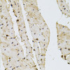 Immunohistochemistry of paraffin-embedded rat heart using PPP2R5C antibody (19-690) at dilution of 1:100 (40x lens) .