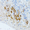 Immunohistochemistry of paraffin-embedded human esophagus using PSRC1 antibody (19-693) at dilution of 1:100 (40x lens) .
