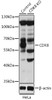 Western blot analysis of extracts from normal (control) and CDK8 knockout (KO) HeLa cells, using CDK8 antibody (19-724) at 1:1000 dilution.<br/>Secondary antibody: HRP Goat Anti-Rabbit IgG (H+L) at 1:10000 dilution.<br/>Lysates/proteins: 25ug per lane.<br/>Blocking buffer: 3% nonfat dry milk in TBST.<br/>Detection: ECL Basic Kit.<br/>Exposure time: 30s.