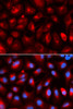 Immunofluorescence analysis of U2OS cells using KLC1 antibody (19-726) . Blue: DAPI for nuclear staining.
