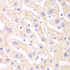 Immunohistochemistry of paraffin-embedded human liver damage using PSMF1 antibody (19-728) at dilution of 1:100 (40x lens) .