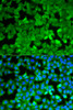 Immunofluorescence analysis of A549 cells using ASNS antibody (19-731) . Blue: DAPI for nuclear staining.