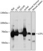 Western blot analysis of extracts of various cell lines, using LCP1 antibody (19-733) at 1:1000 dilution.<br/>Secondary antibody: HRP Goat Anti-Rabbit IgG (H+L) at 1:10000 dilution.<br/>Lysates/proteins: 25ug per lane.<br/>Blocking buffer: 3% nonfat dry milk in TBST.<br/>Detection: ECL Basic Kit.<br/>Exposure time: 5s.