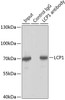 Immunoprecipitation analysis of 150ug extracts of Jurkat cells using 3ug LCP1 antibody (19-733) . Western blot was performed from the immunoprecipitate using LCP1 antibody (19-733) at a dilition of 1:1000.