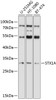 Western blot analysis of extracts of various cell lines, using STX1A antibody (19-739) at 1:1000 dilution.<br/>Secondary antibody: HRP Goat Anti-Rabbit IgG (H+L) at 1:10000 dilution.<br/>Lysates/proteins: 25ug per lane.<br/>Blocking buffer: 3% nonfat dry milk in TBST.<br/>Detection: ECL Basic Kit.<br/>Exposure time: 60s.