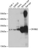 Western blot analysis of extracts of various cell lines, using CRYBB2 antibody (19-740) at 1:1000 dilution.<br/>Secondary antibody: HRP Goat Anti-Rabbit IgG (H+L) at 1:10000 dilution.<br/>Lysates/proteins: 25ug per lane.<br/>Blocking buffer: 3% nonfat dry milk in TBST.<br/>Detection: ECL Basic Kit.<br/>Exposure time: 15s.